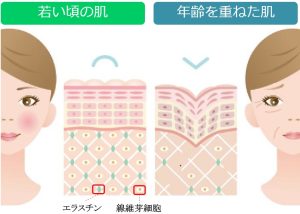 加齢による肌の変化