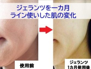 ジェランツを1カ月使用した肌の変化